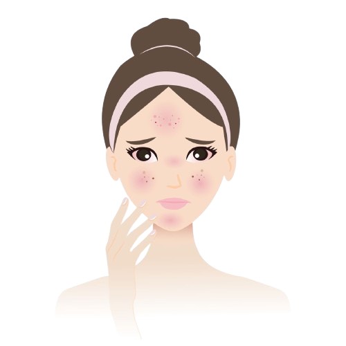 Dry Skin
