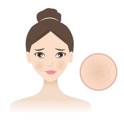 Sensitive Skin